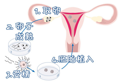 一般不妊検査・タイミング療法